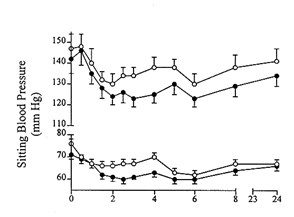 graphs